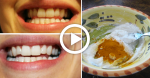 He Makes A Paste Using THIS Common Ingredient To Whiten His Teeth And Reverse Gum Disease!