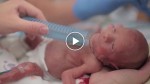 This baby was almost dying, but watch how he survived. This is truly amazing!