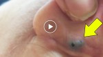 They thought it was simply a black spot behind the ear, but watch what they discovered!